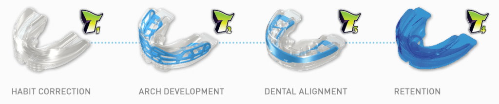 myobrace-stages